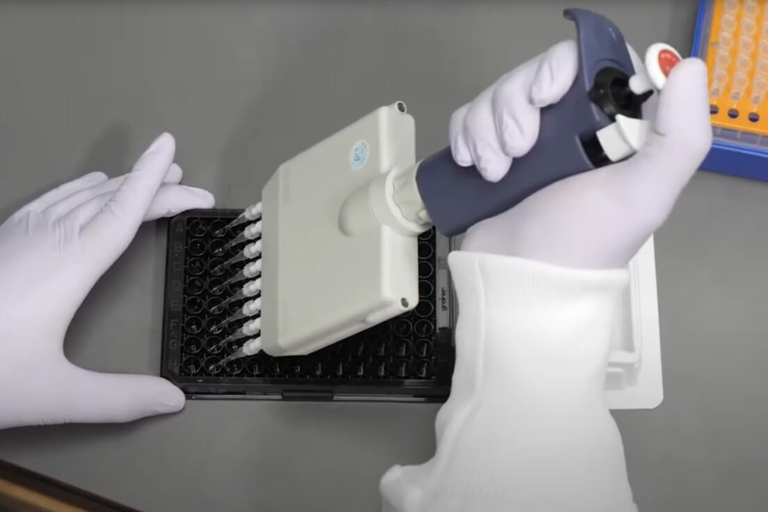 Luminex xMAP® Assay Automation - Diasorin