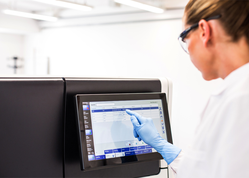 Test Diagnostico LIAISON® per la determinazione di Retrovirus - Diasorin