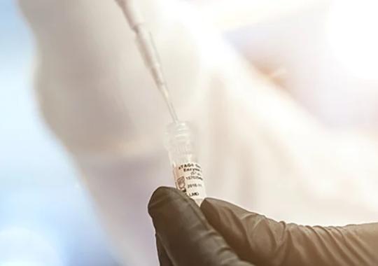 How to Reduce Coupling Variability with Luminex Bead Assays