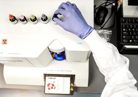 Bead-Based Multiplex Assay Shines in Performance Analysis